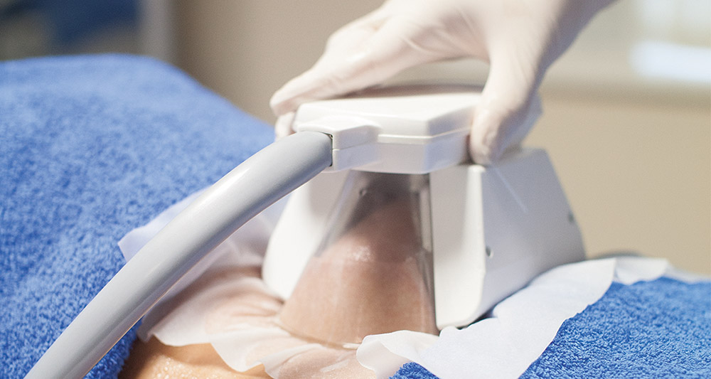 How Fat Freezing and HIFU Work Together? 2 Multiple Areas in One Session HIFU and Fat Freezing Wealdstone