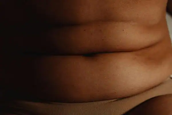 The Hidden Connection: How Stress Shapes Your Fitness and Body Composition 3 image of what stress can do on the stomach area and how Lipo 360 Wealdstone can help to change your body shape.